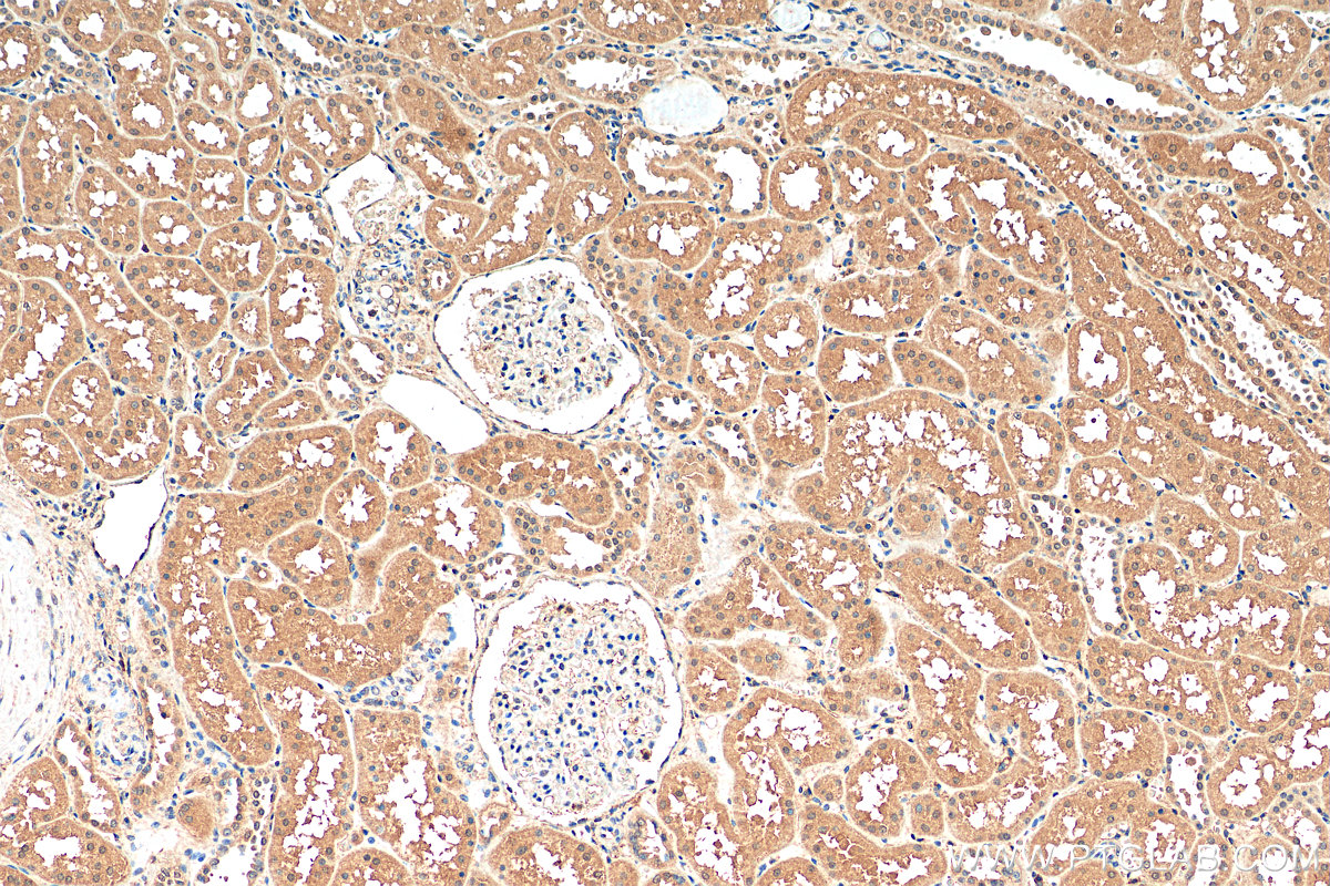 IHC staining of human kidney using 14942-1-AP