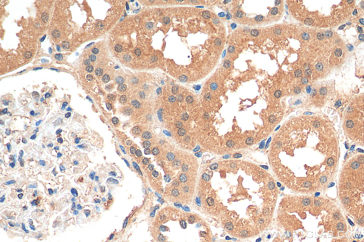 IHC staining of human kidney using 14942-1-AP