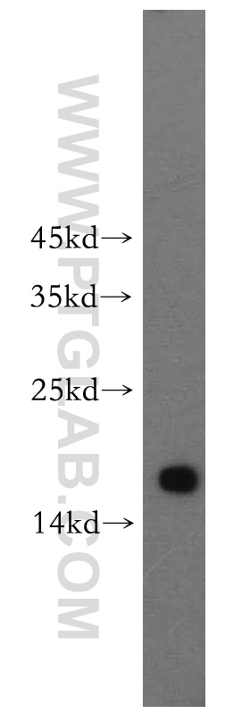 WB analysis of HeLa using 15603-1-AP