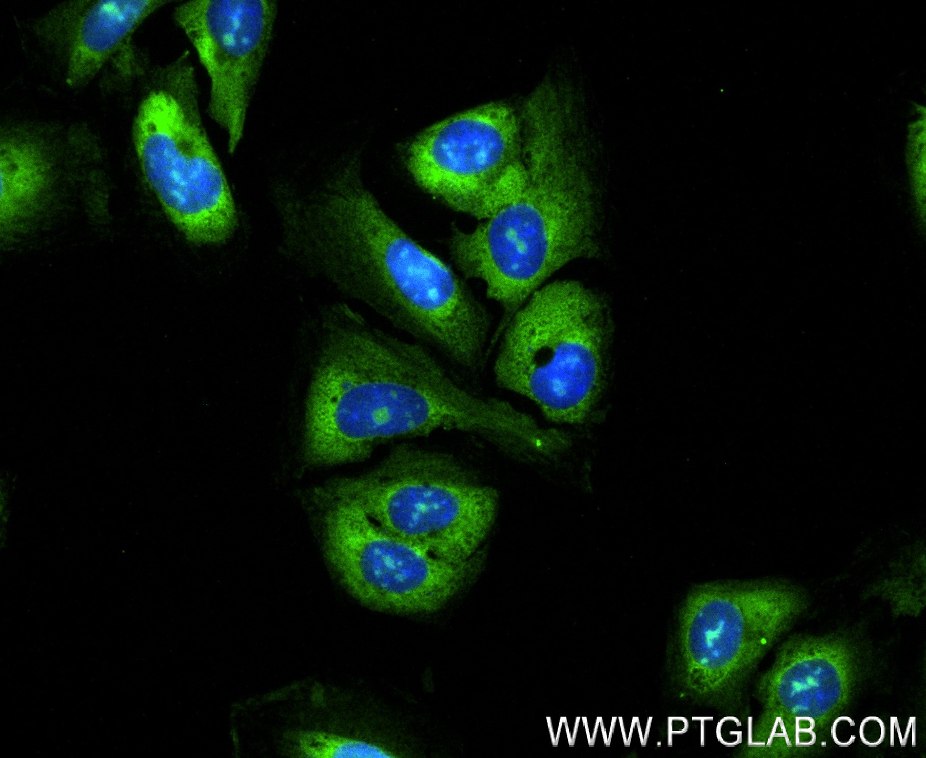 IF Staining of U2OS using 83848-4-RR (same clone as 83848-4-PBS)