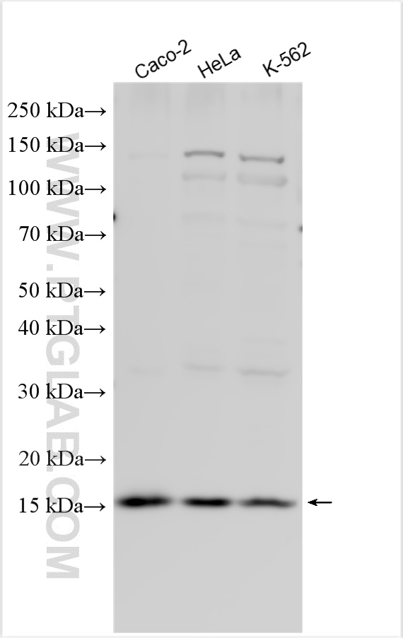 WB analysis using 15085-1-AP