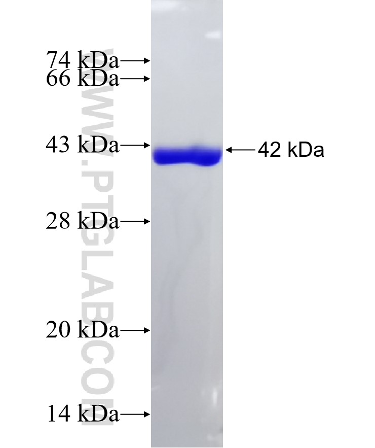 RPS19 fusion protein Ag7164 SDS-PAGE