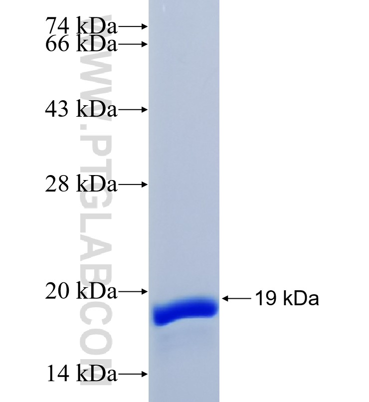 RPS19 fusion protein Ag7220 SDS-PAGE RPS19 fusion protein Ag7220 SDS-PAGE