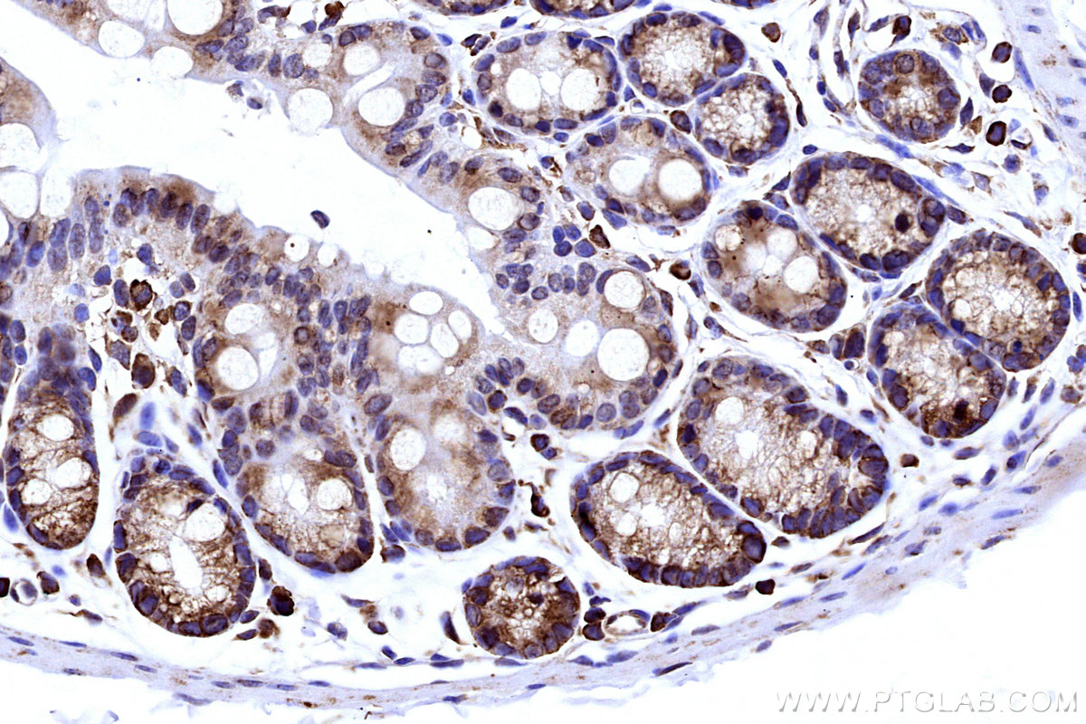 IHC staining of mouse colon using 15562-1-AP IHC staining of mouse colon using 15562-1-AP