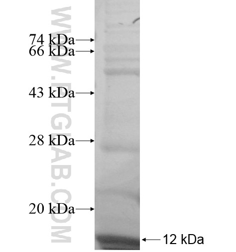 RPS21 fusion protein Ag10643 SDS-PAGE RPS21 fusion protein Ag10643 SDS-PAGE