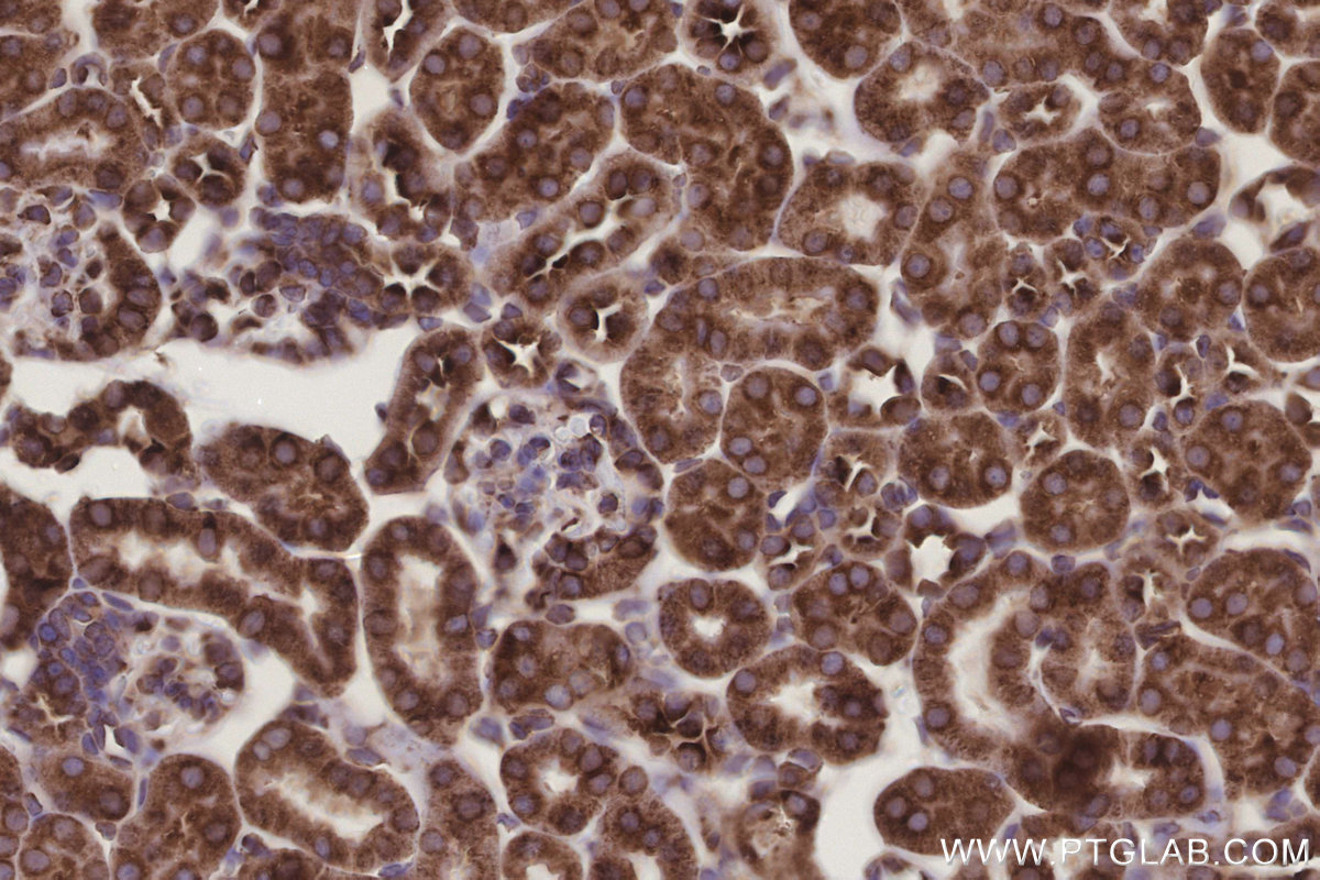 IHC staining of mouse kidney using 29834-1-AP (same clone as 29834-1-PBS)