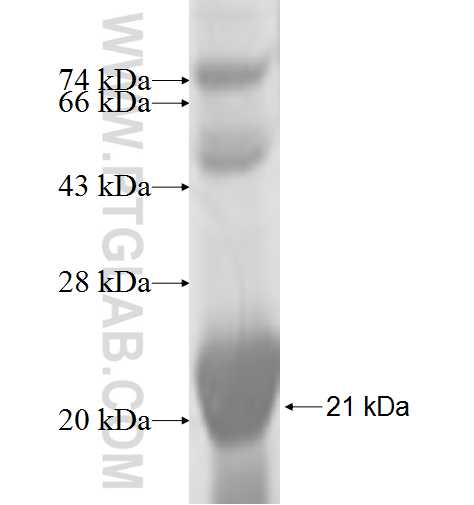RPS24 fusion protein Ag6598 SDS-PAGE RPS24 fusion protein Ag6598 SDS-PAGE