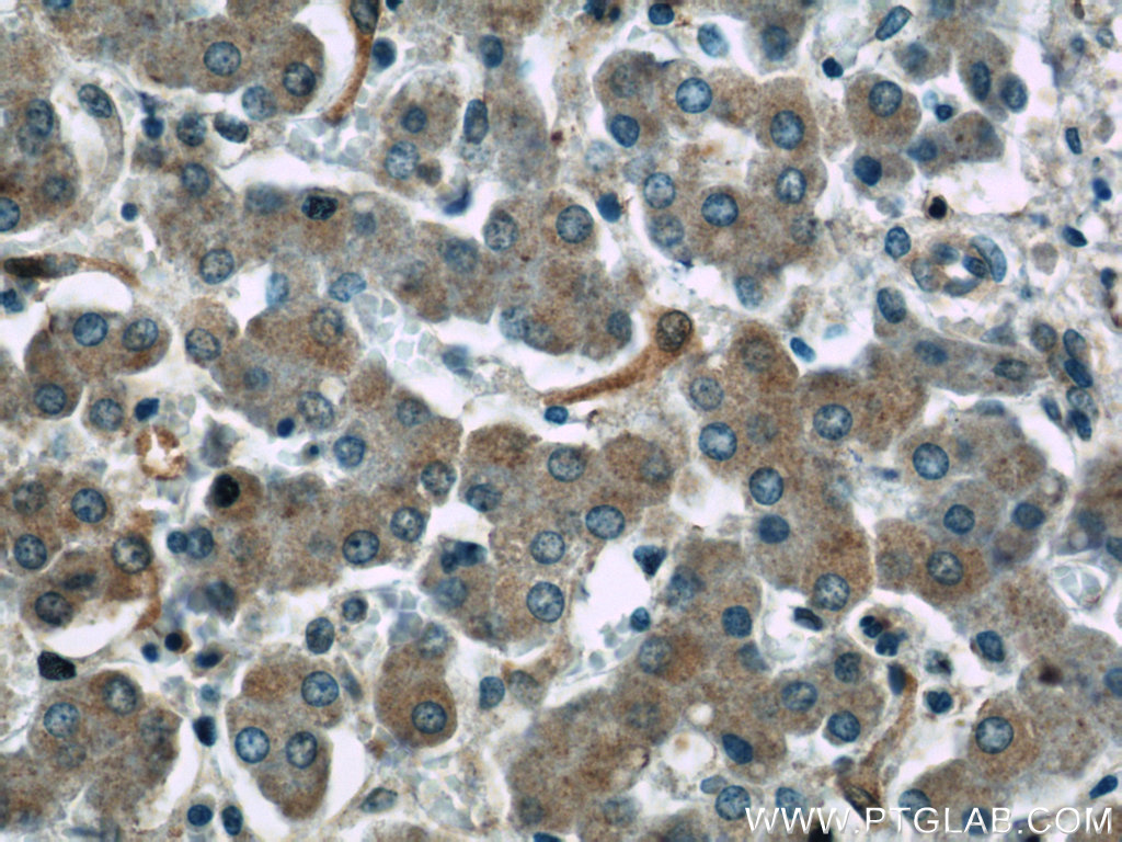 IHC staining of human liver using 23599-1-AP