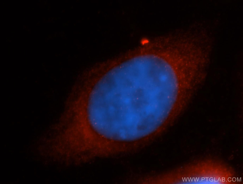 IF Staining of MCF-7 using 14909-1-AP