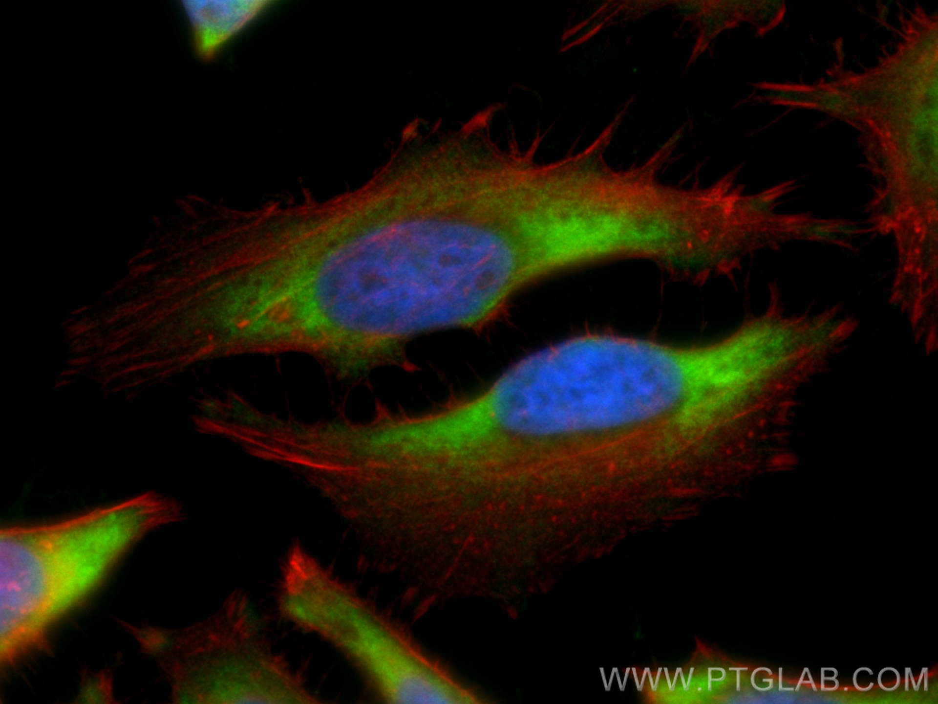 IF Staining of HeLa using 15355-1-AP