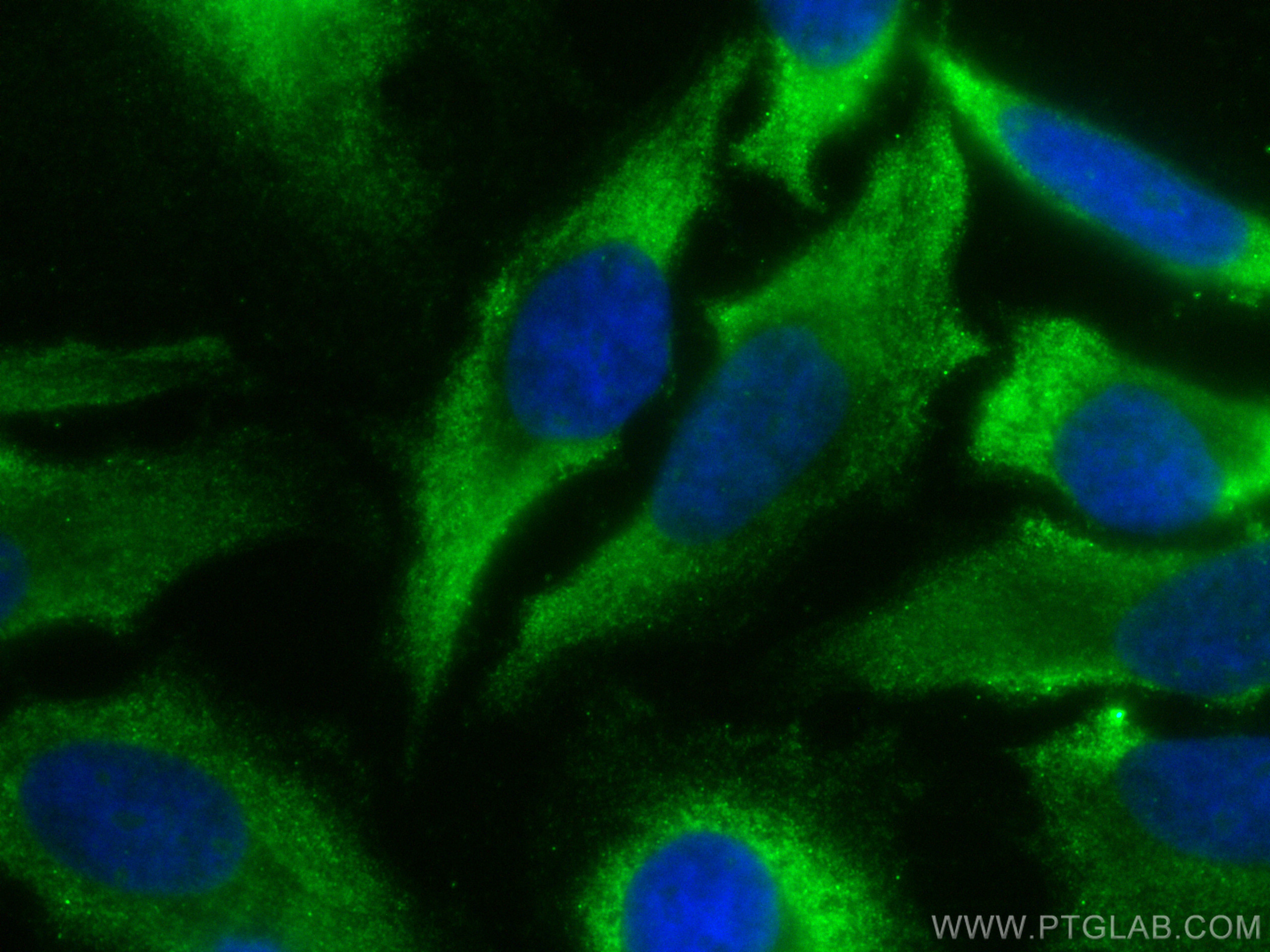 IF Staining of HeLa using CL488-14946