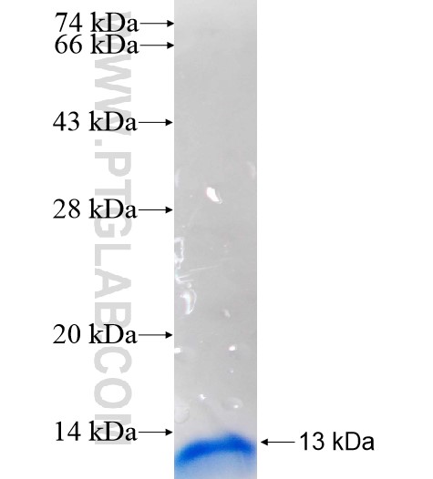 RPS29 fusion protein Ag11356 SDS-PAGE RPS29 fusion protein Ag11356 SDS-PAGE