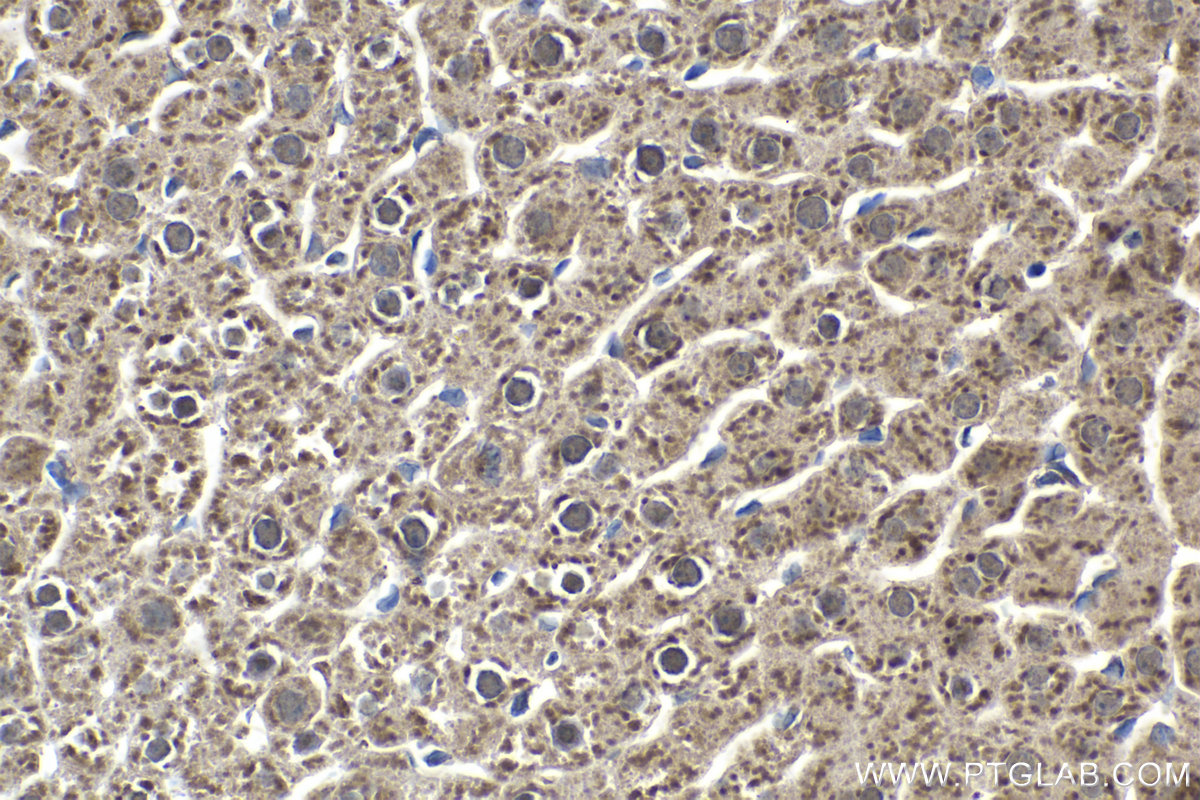 IHC staining of rat liver using 11990-1-AP