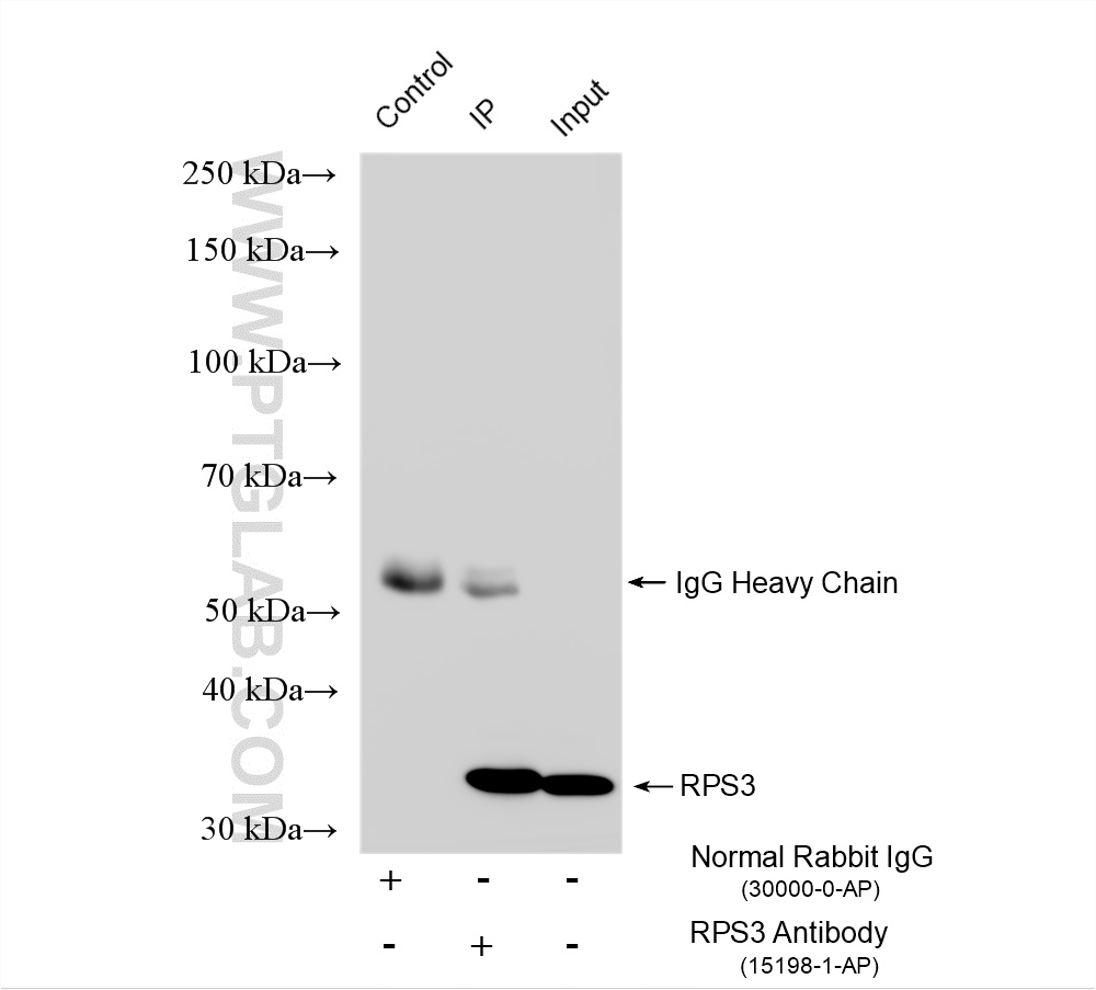 IP experiment of HeLa using 15198-1-AP IP experiment of HeLa using 15198-1-AP