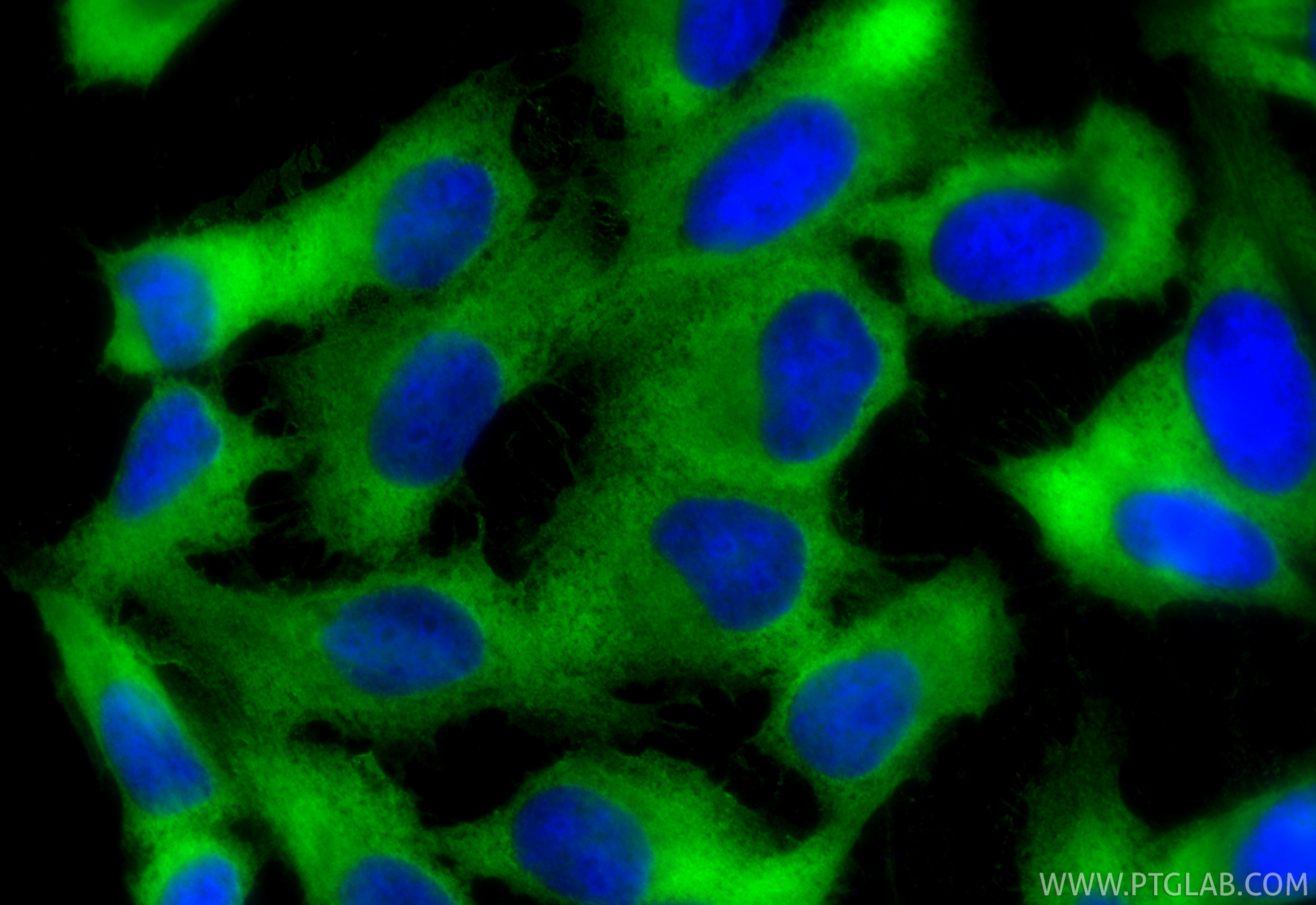 IF Staining of U2OS using 66046-1-Ig