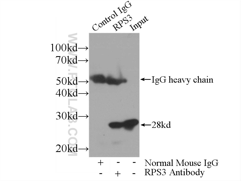 IP experiment of HEK-293 using 66046-1-Ig