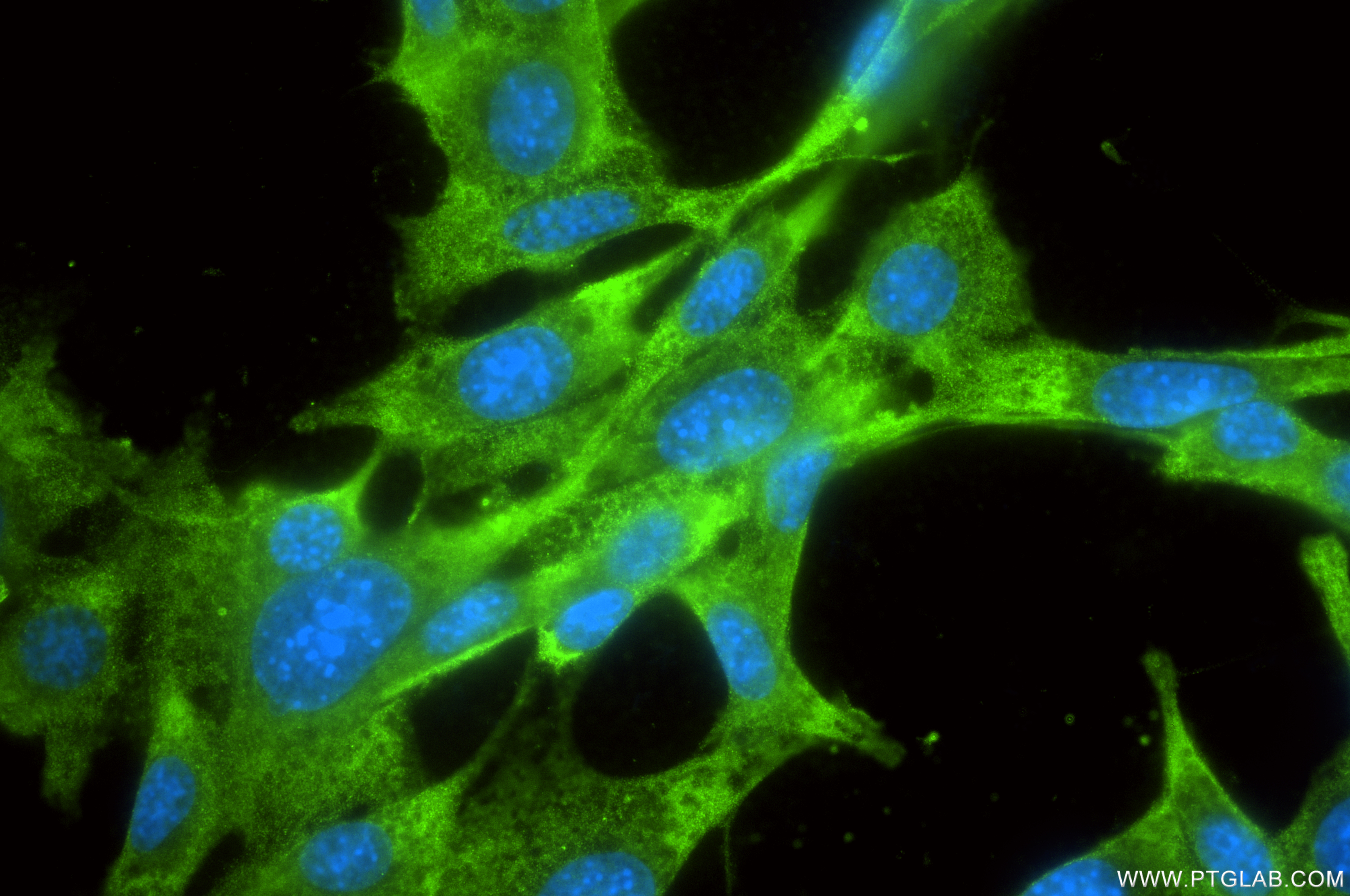 IF Staining of NIH/3T3 using 84947-4-RR