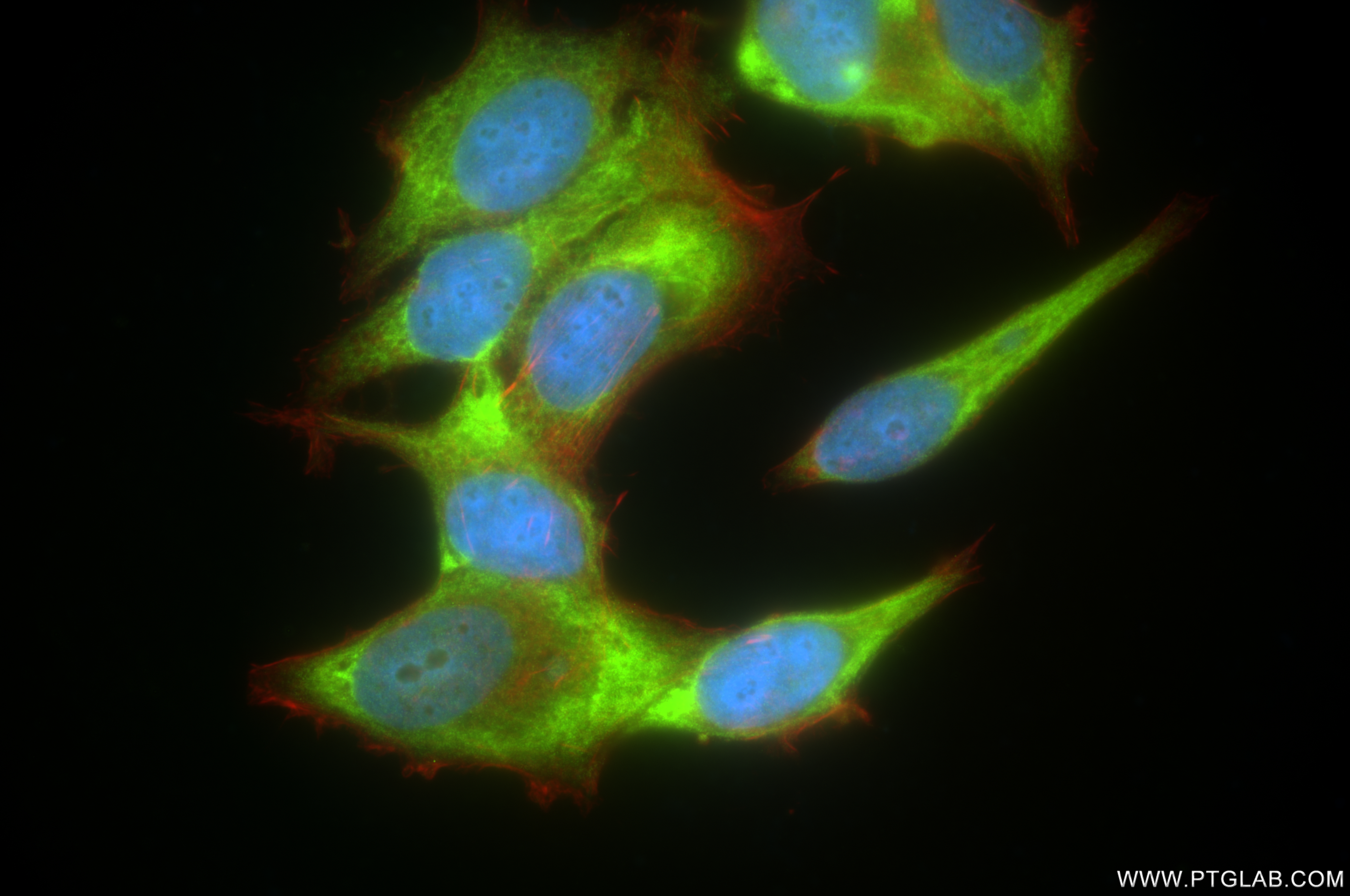 IF Staining of MCF-7 using 85040-5-RR