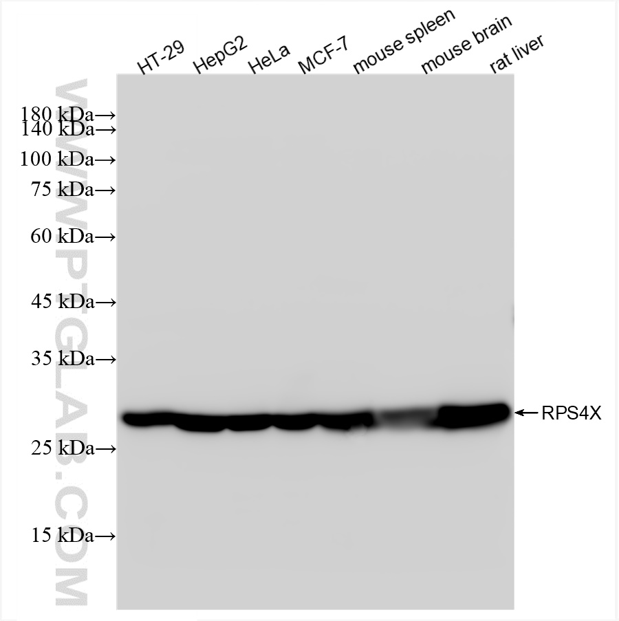 WB analysis using 85040-5-RR