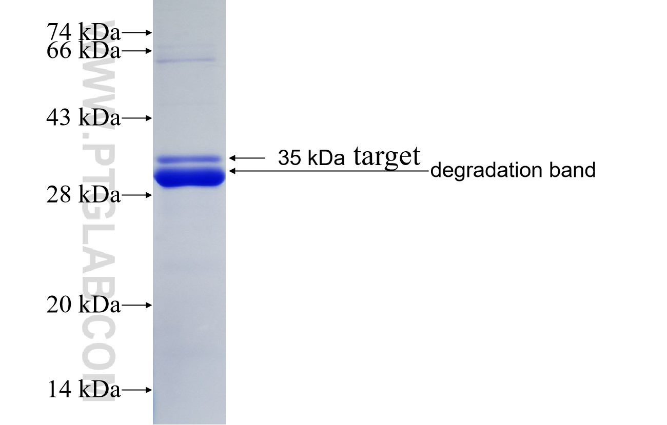 RPS4Y1 fusion protein Ag11149 SDS-PAGE