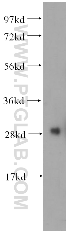 WB analysis of K-562 using 14823-1-AP