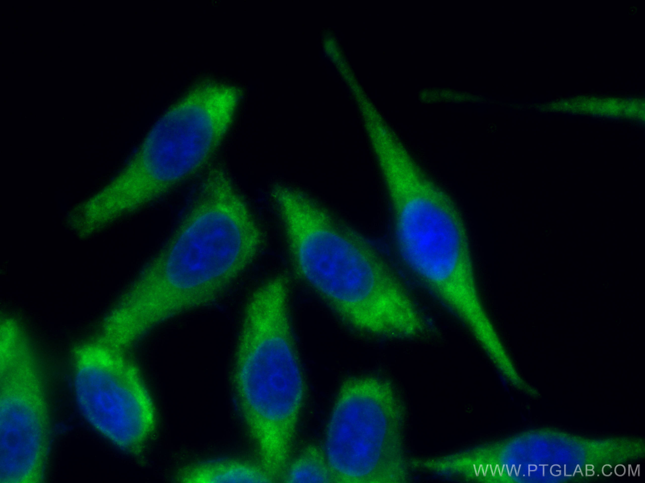 IF Staining of HepG2 using 80208-1-RR