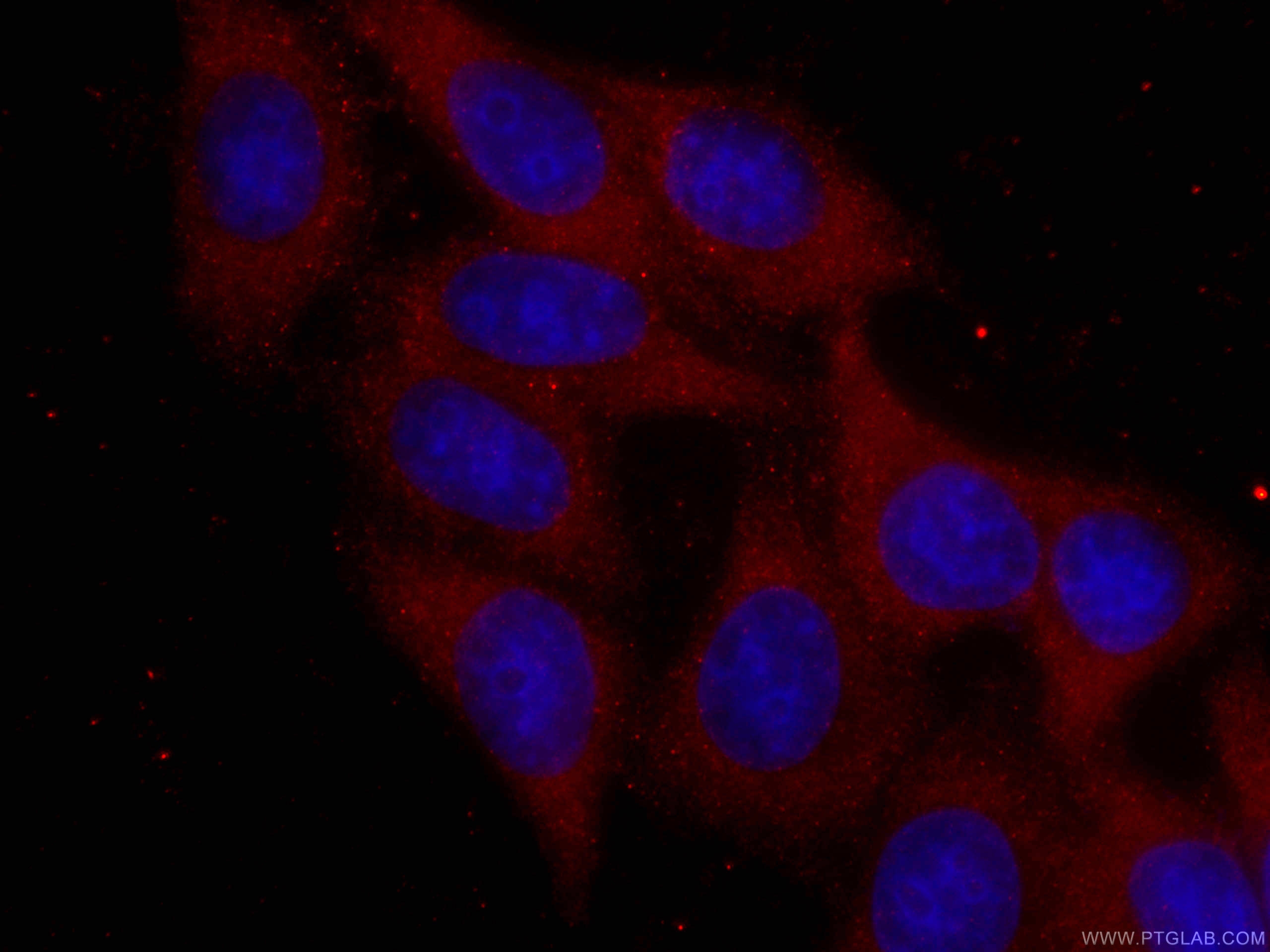 S6 Ribosomal protein