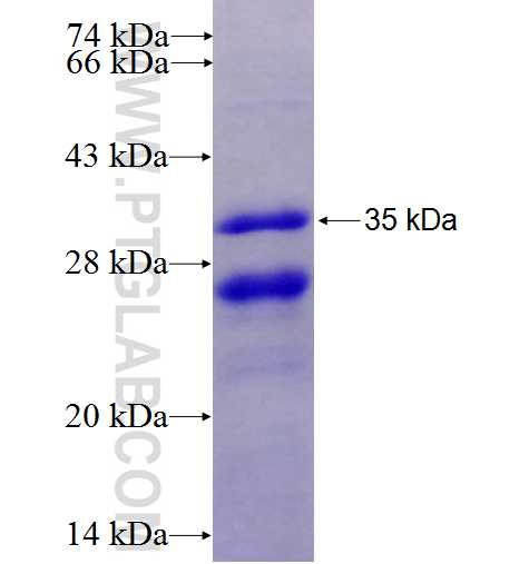 RPS6 fusion protein Ag6599 SDS-PAGE