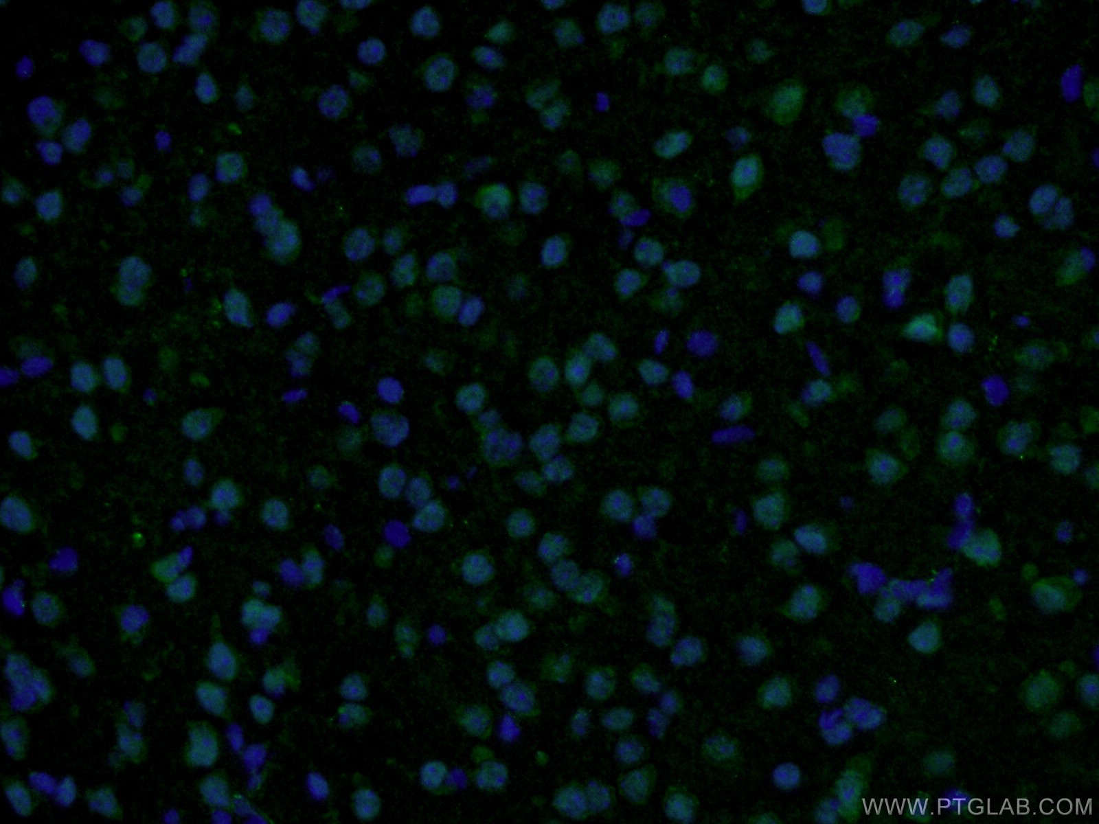 IF Staining of mouse brain using 23762-1-AP