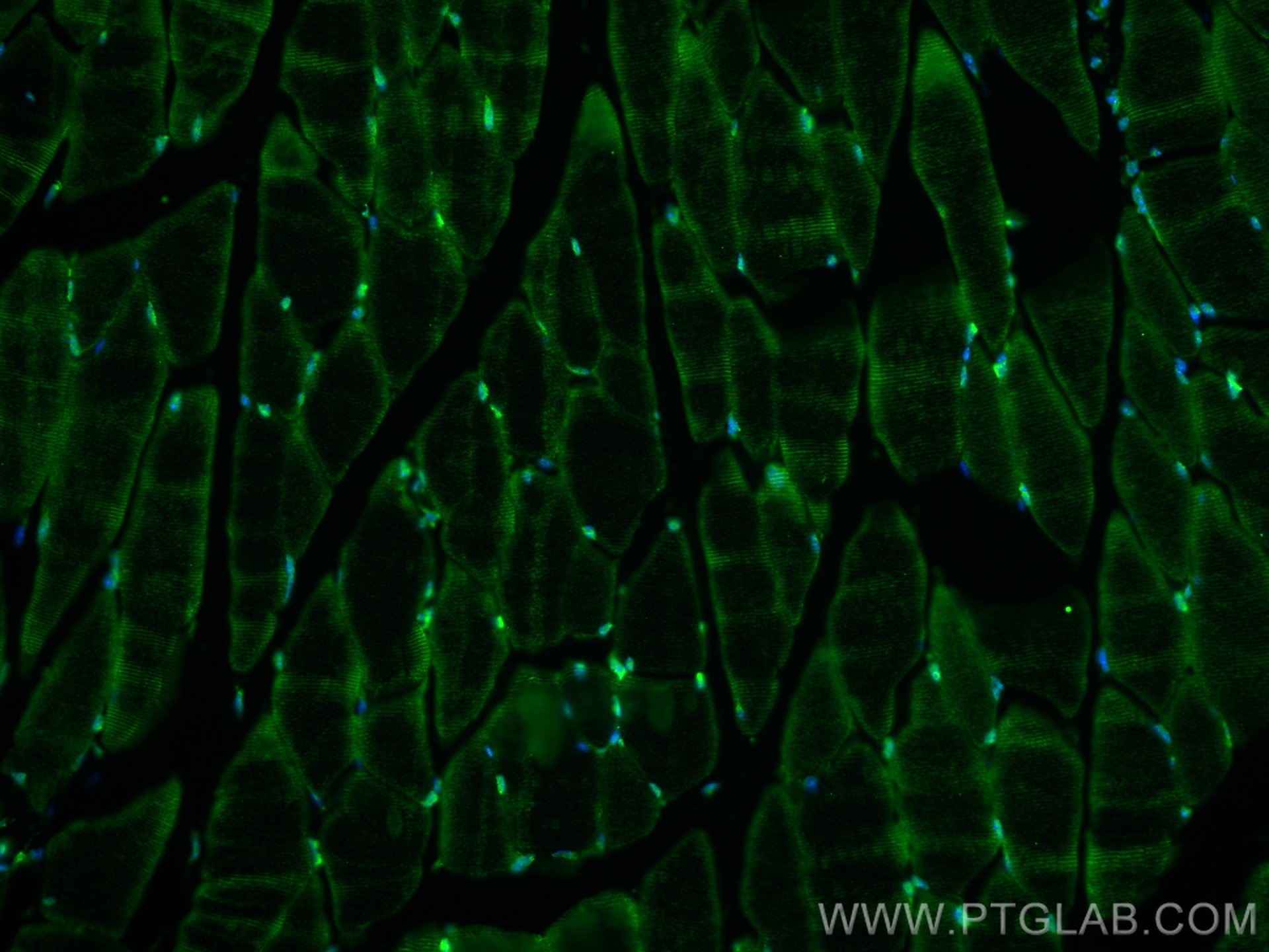 IF Staining of mouse skeletal muscle using 23762-1-AP