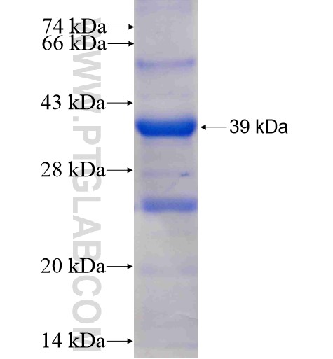 RPS6KA4 fusion protein Ag7414 SDS-PAGE RPS6KA4 fusion protein Ag7414 SDS-PAGE