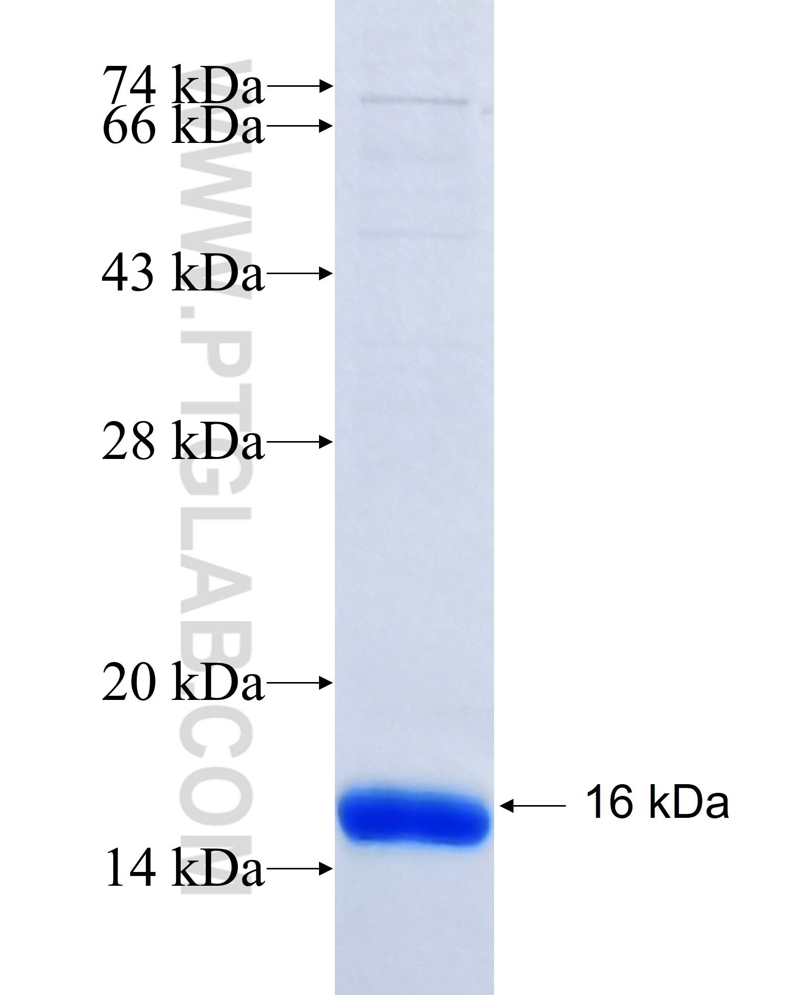 RPS6KA6 fusion protein Ag17382 SDS-PAGE