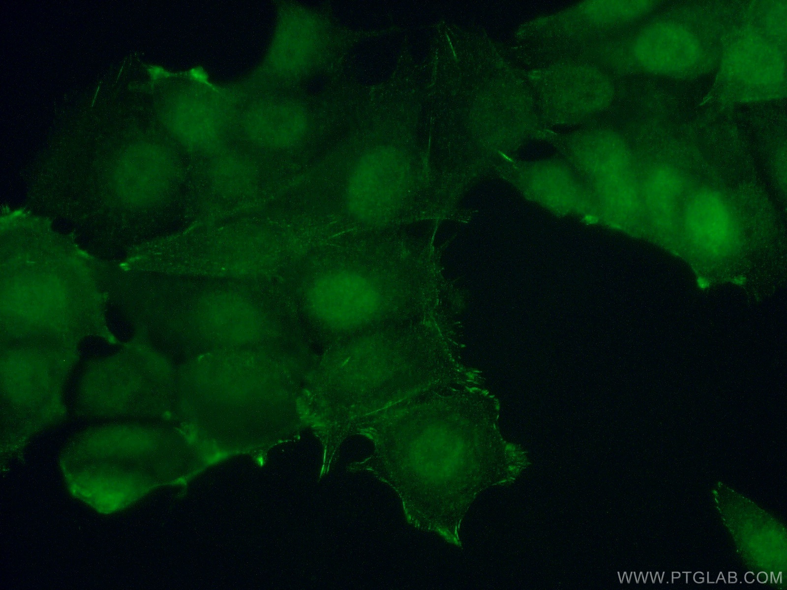 IF Staining of MCF-7 using 15268-1-AP