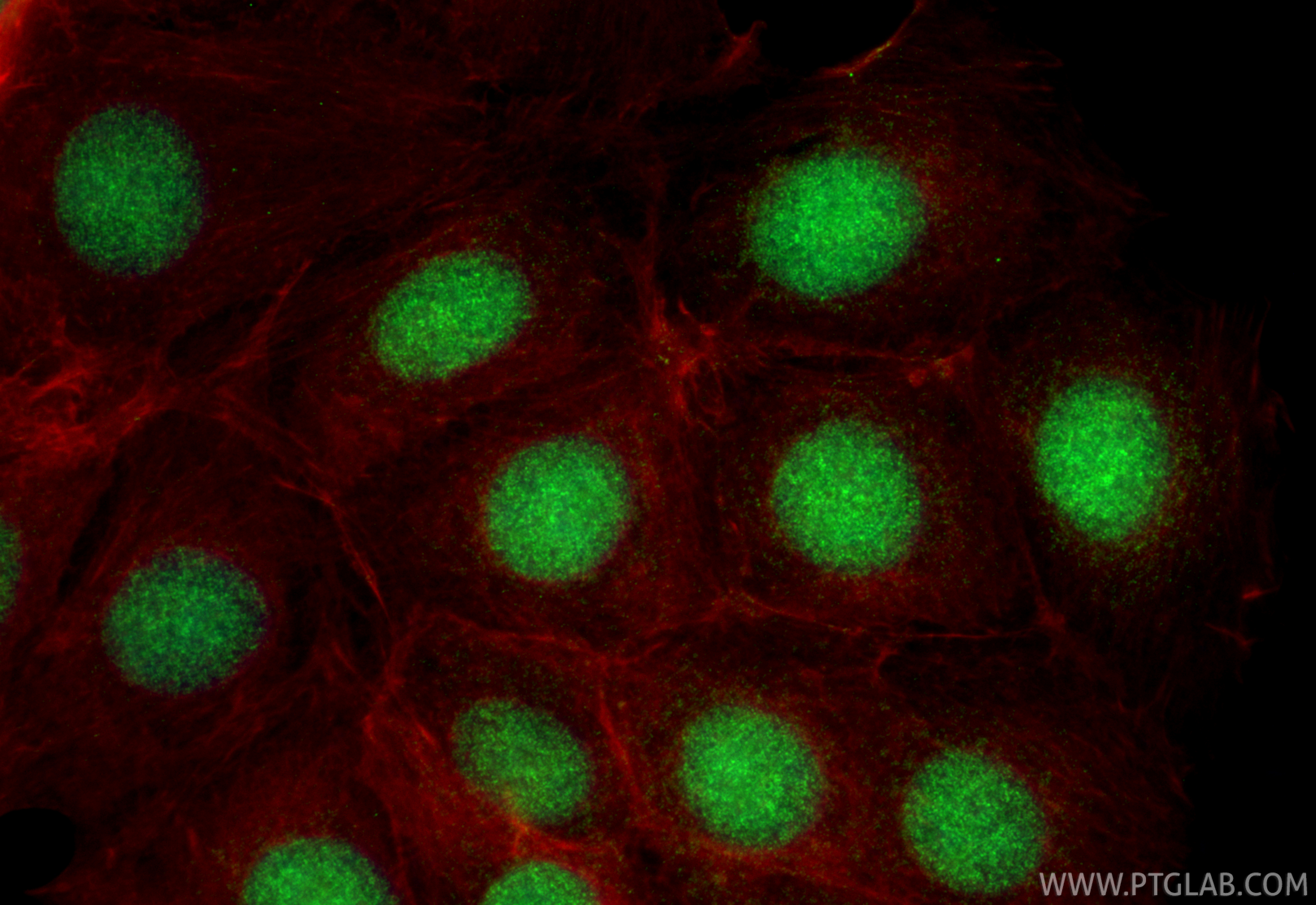 IF Staining of MCF-7 using 15268-1-AP (same clone as 15268-1-PBS)