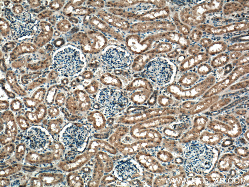 IHC staining of human kidney using 15268-1-AP