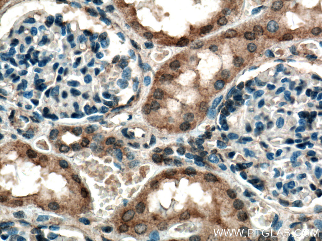 IHC staining of human kidney using 15268-1-AP