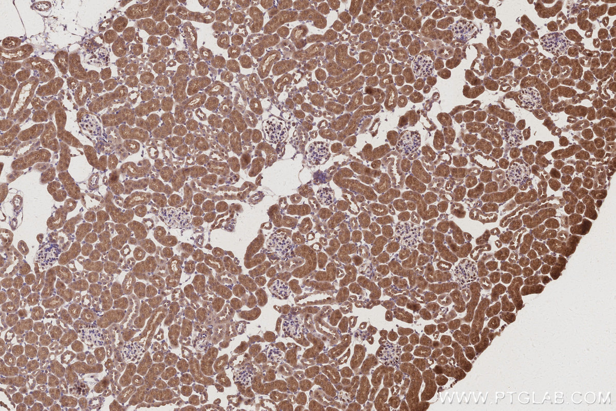 IHC staining of mouse kidney using 15268-1-AP IHC staining of mouse kidney using 15268-1-AP