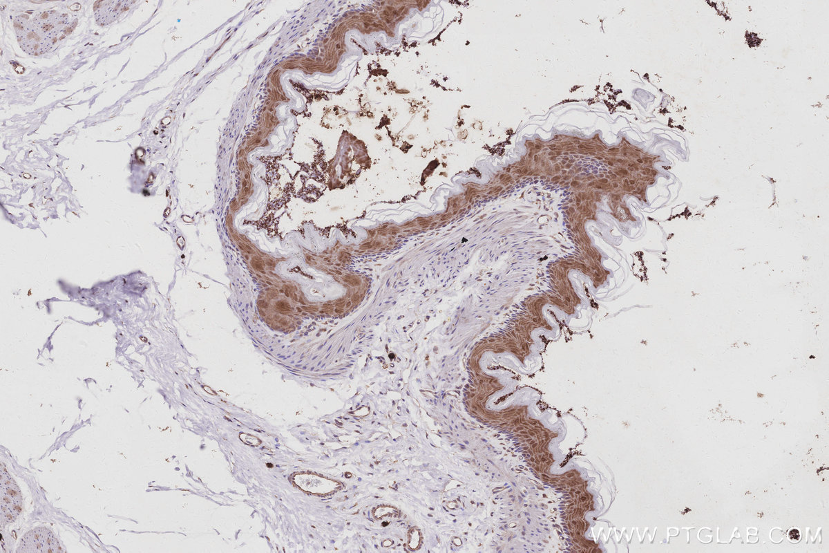IHC staining of rat stomach using 15268-1-AP IHC staining of rat stomach using 15268-1-AP
