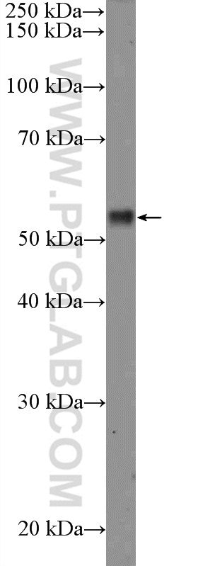 WB analysis of MCF-7 using 26194-1-AP