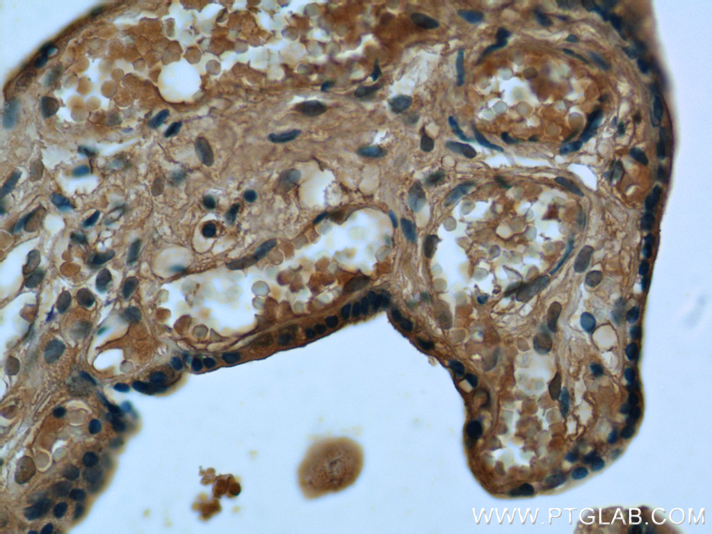 IHC staining of human placenta using 14491-1-AP