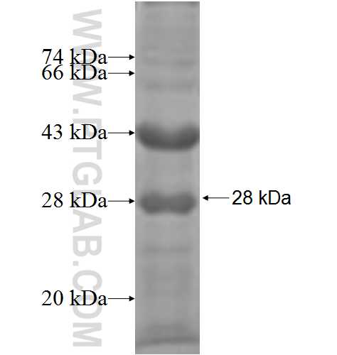 RPS7 fusion protein Ag5999 SDS-PAGE