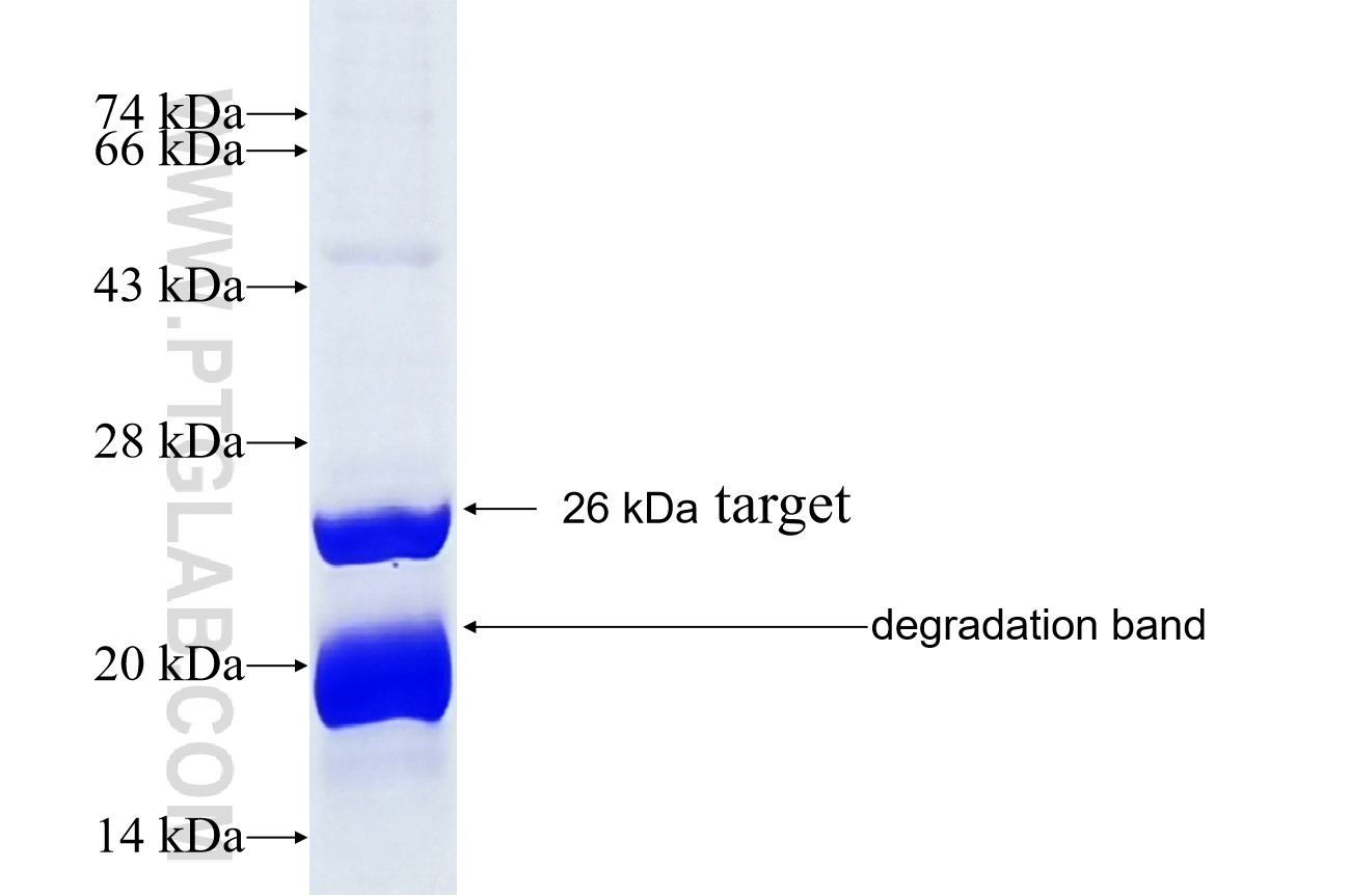 RPS7 fusion protein Ag5999 SDS-PAGE RPS7 fusion protein Ag5999 SDS-PAGE