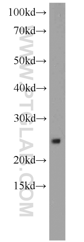 WB analysis of mouse uterus using 18215-1-AP