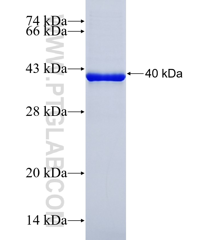 RPTN fusion protein Ag23257 SDS-PAGE