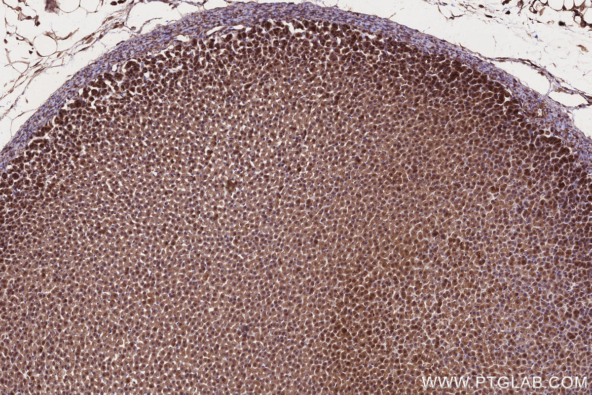 IHC staining of rat adrenal gland using 20984-1-AP