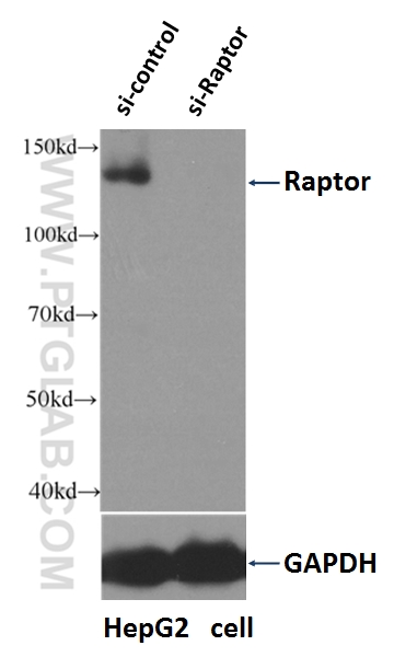 WB analysis of HepG2 cells using 20984-1-AP