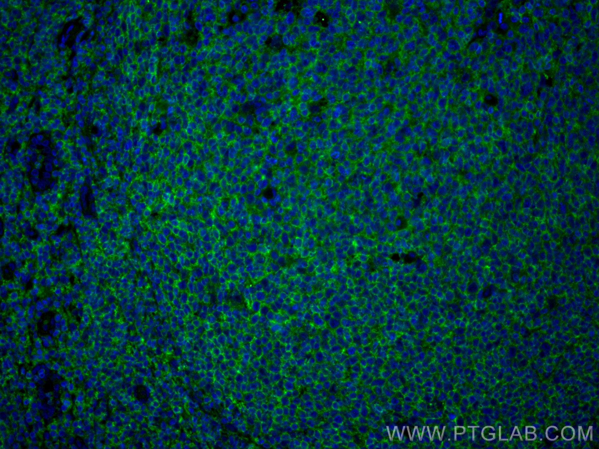 IF Staining of human tonsillitis using 20103-1-AP