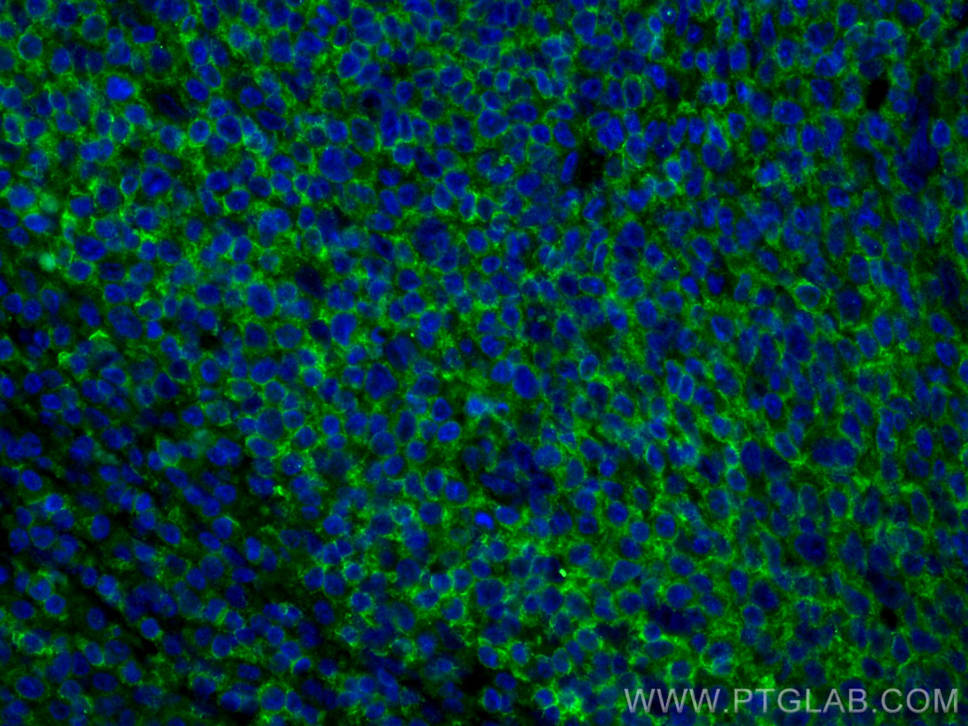 IF Staining of human tonsillitis using 20103-1-AP