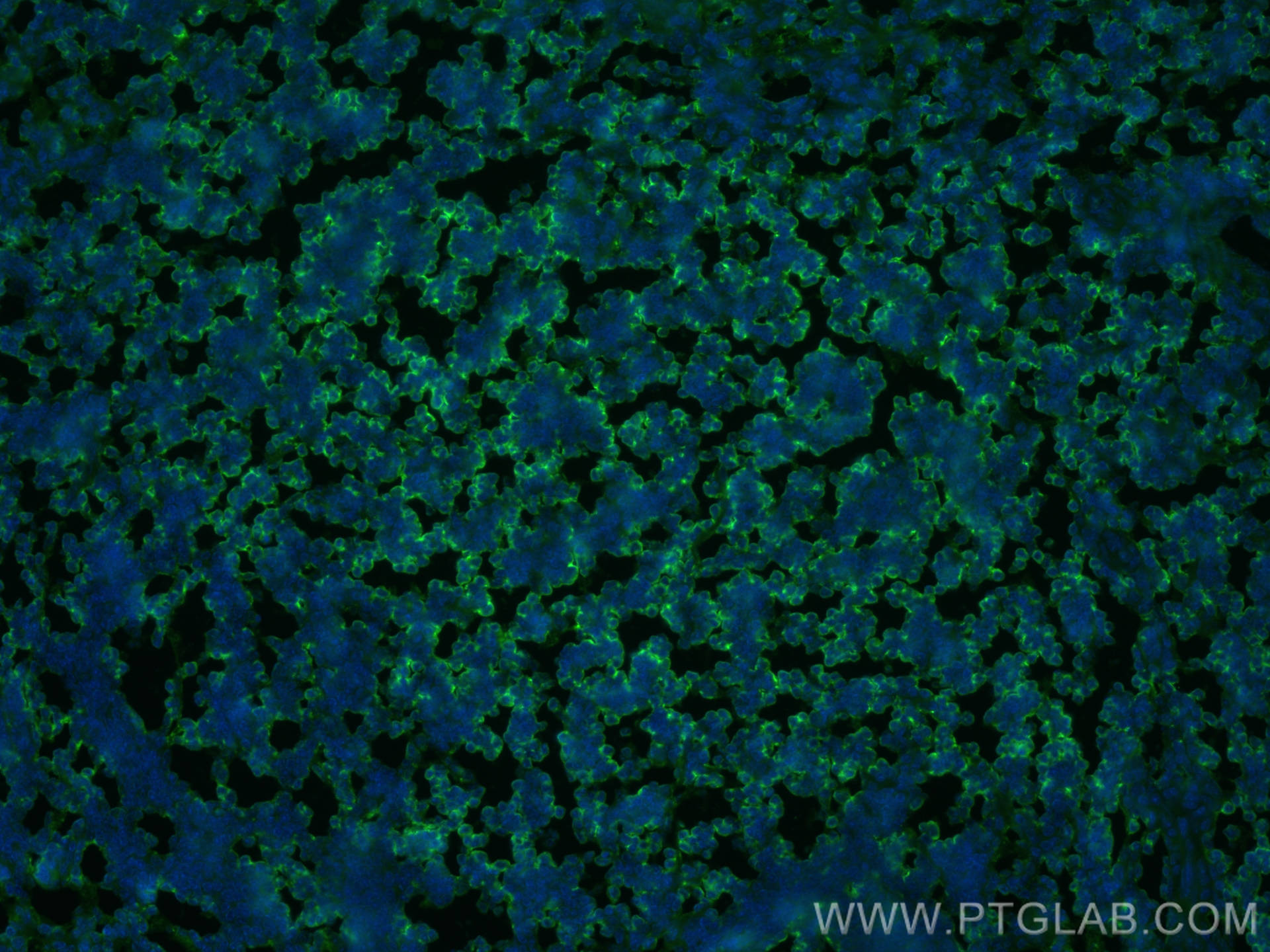 IF Staining of mouse spleen using 20103-1-AP
