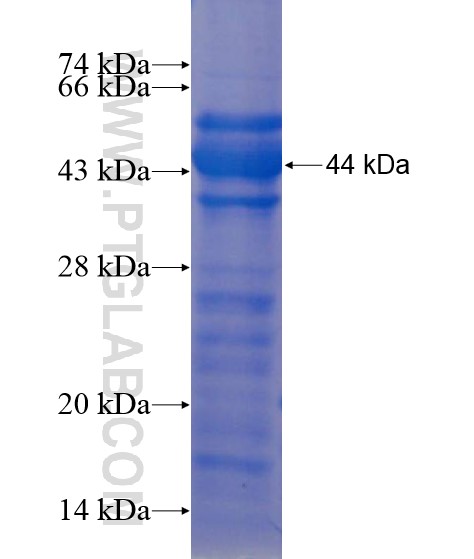 RPUSD1 fusion protein Ag22314 SDS-PAGE